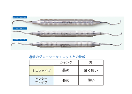 グレーシーキュレット アフターファイブ